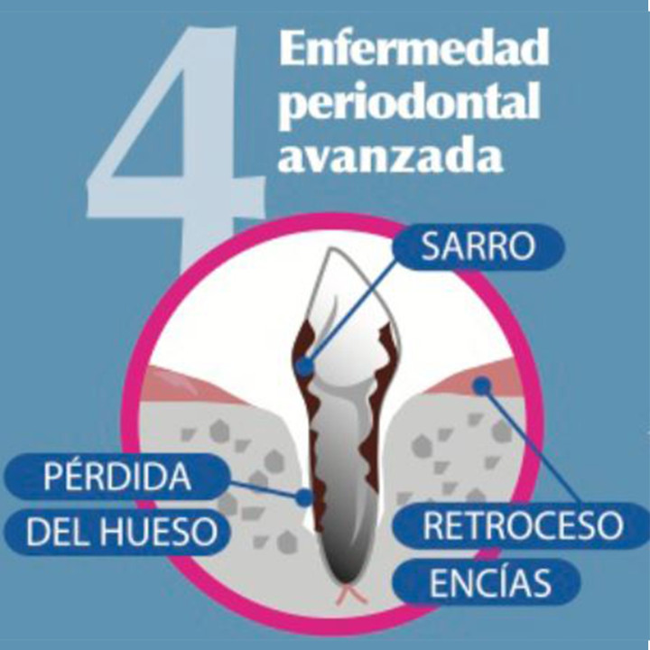 Orozyme Tiras Dentífricas, snacks para perro - Kompymascotas